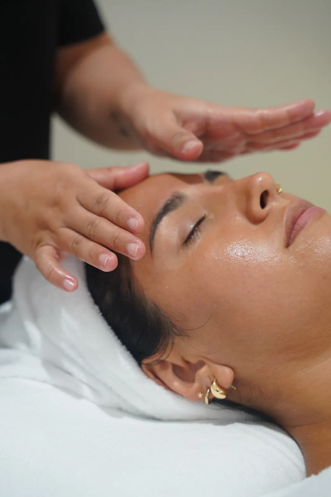 Pro Plump Microneedling