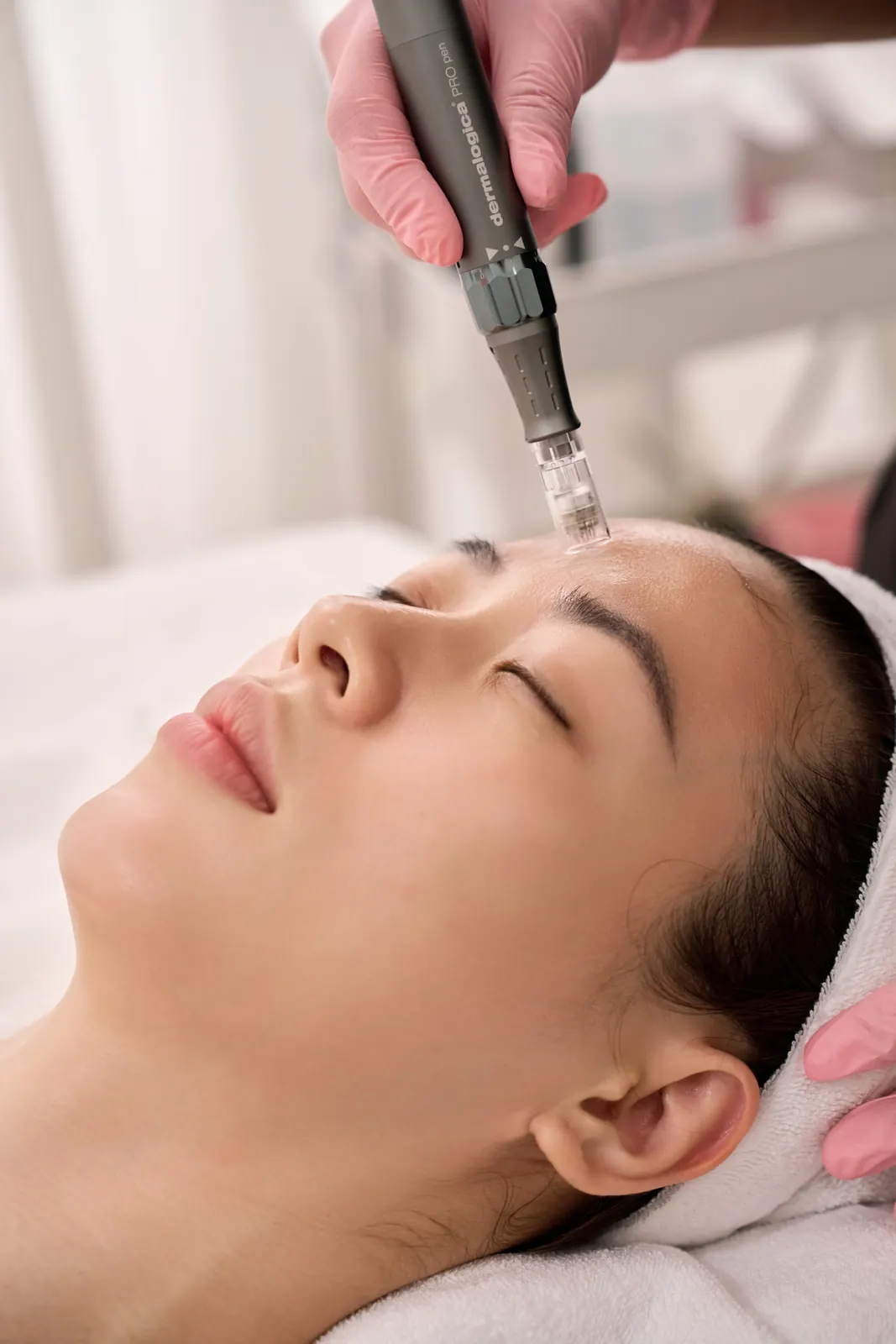 Pro Microneedling